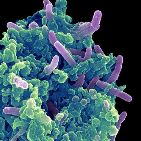 xbree.tb|tb caused by bacteria.